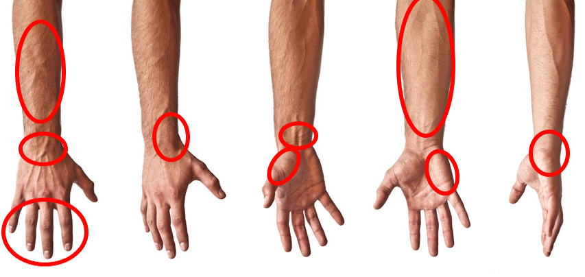 Wrist Pain Cheat Sheets