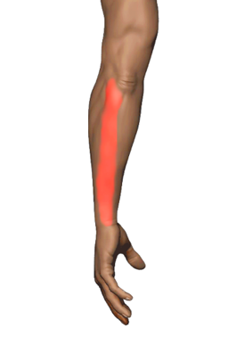 Ulnar Wrist