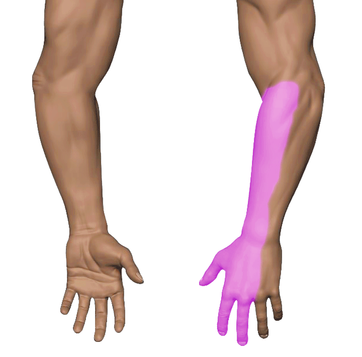 Back of Hand Numbness — Wartenberg Syndrome