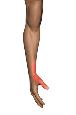 Back Side Thumb Pain — Thumb Bind Tendinopathy · De Quervain's