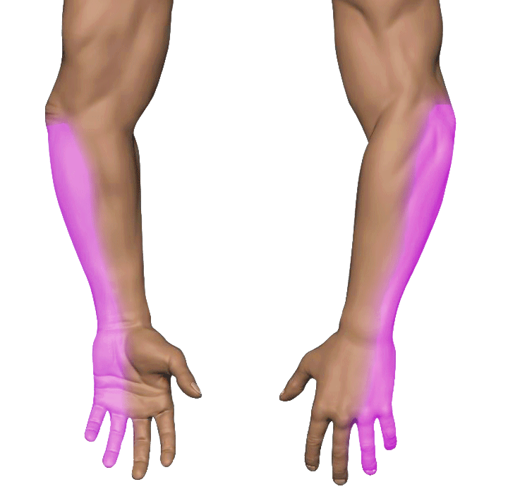 Pinky Numbness / Tingling — Cubital Tunnel Syndrome