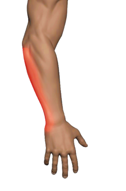 Pinky Side Wrist Pain — Flick Wrist · ECU Tendinopathy