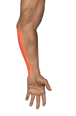 Inner Elbow Pain — Golfer's Elbow · Medial Epicondylosis