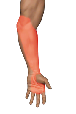 Palm Side Wrist Pain — Creative Warrior Tendinopathy