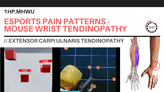 Mouse Wrist Tendinopathy - #3 Wrist Pain with Gaming