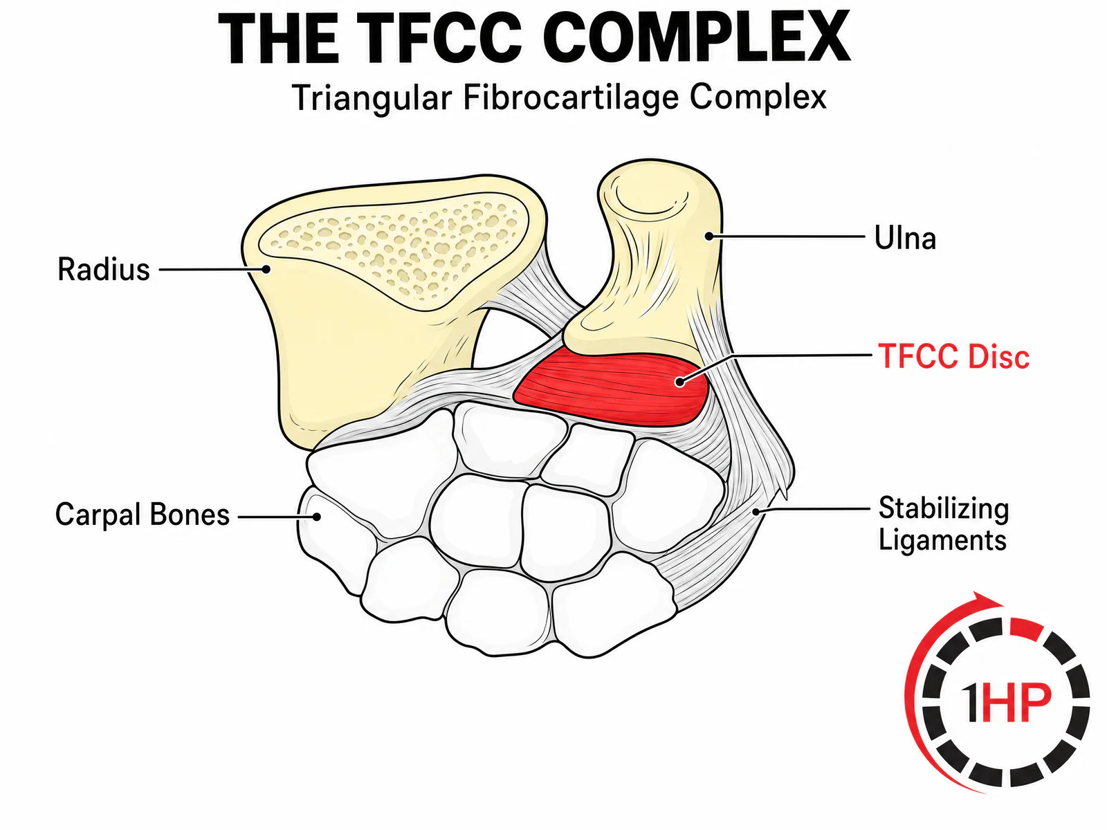 Anatomical cross-section showing the TFCC complex in the wrist