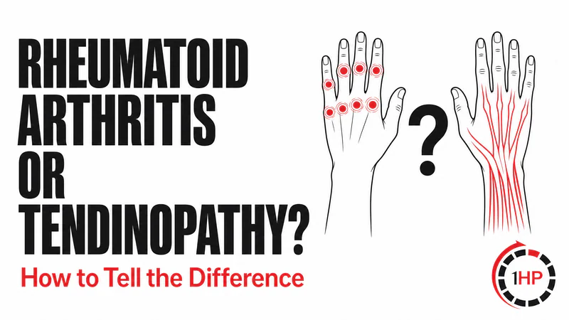 Rheumatoid Arthritis vs Tendinopathy: How to Tell