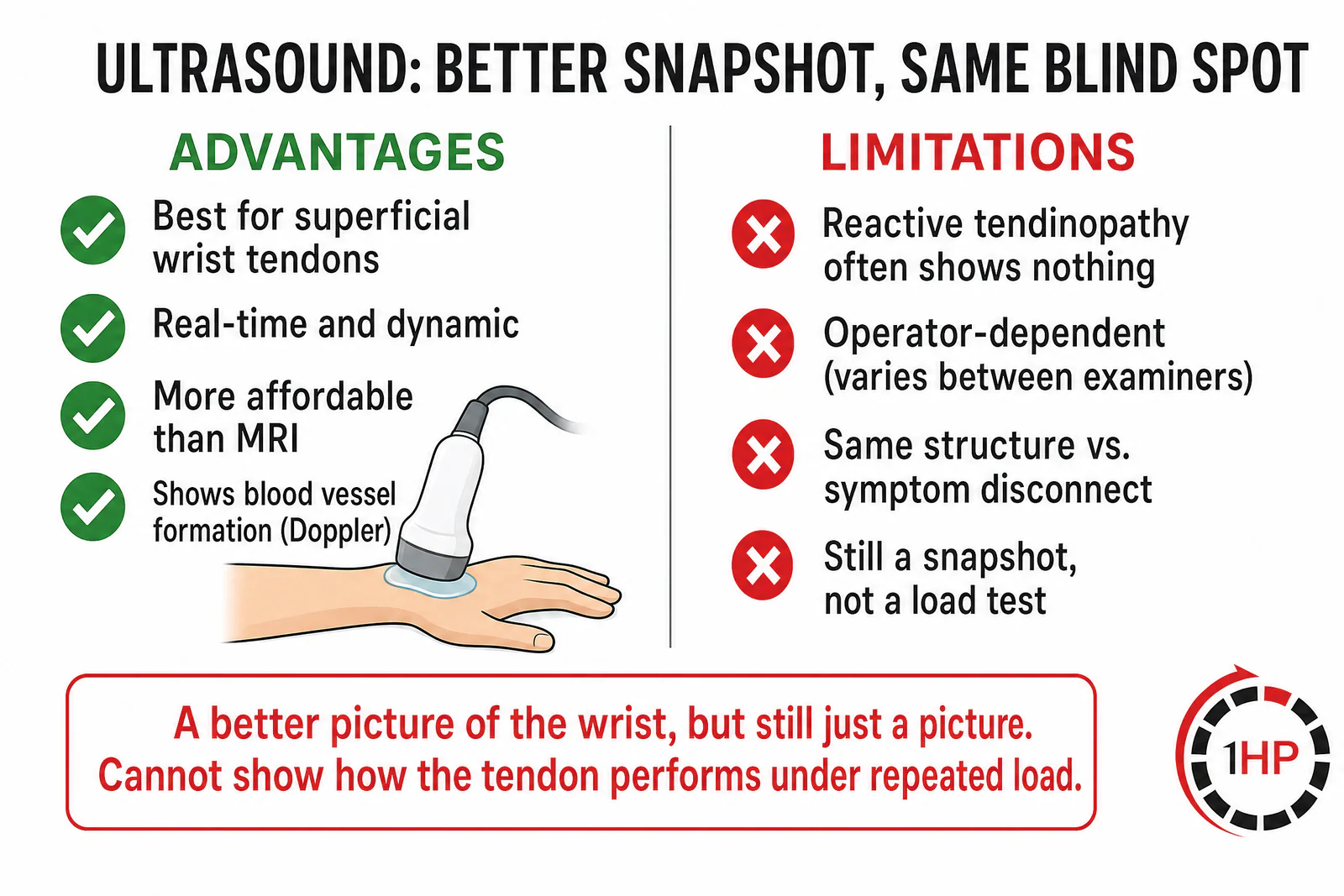 Ultrasound Better Snapshot Same Blind Spot infographic showing advantages and limitations