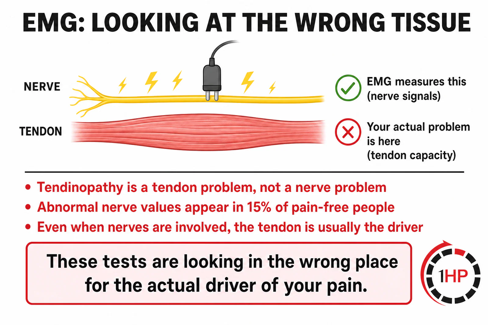 EMG Looking at the Wrong Tissue infographic comparing nerve and tendon