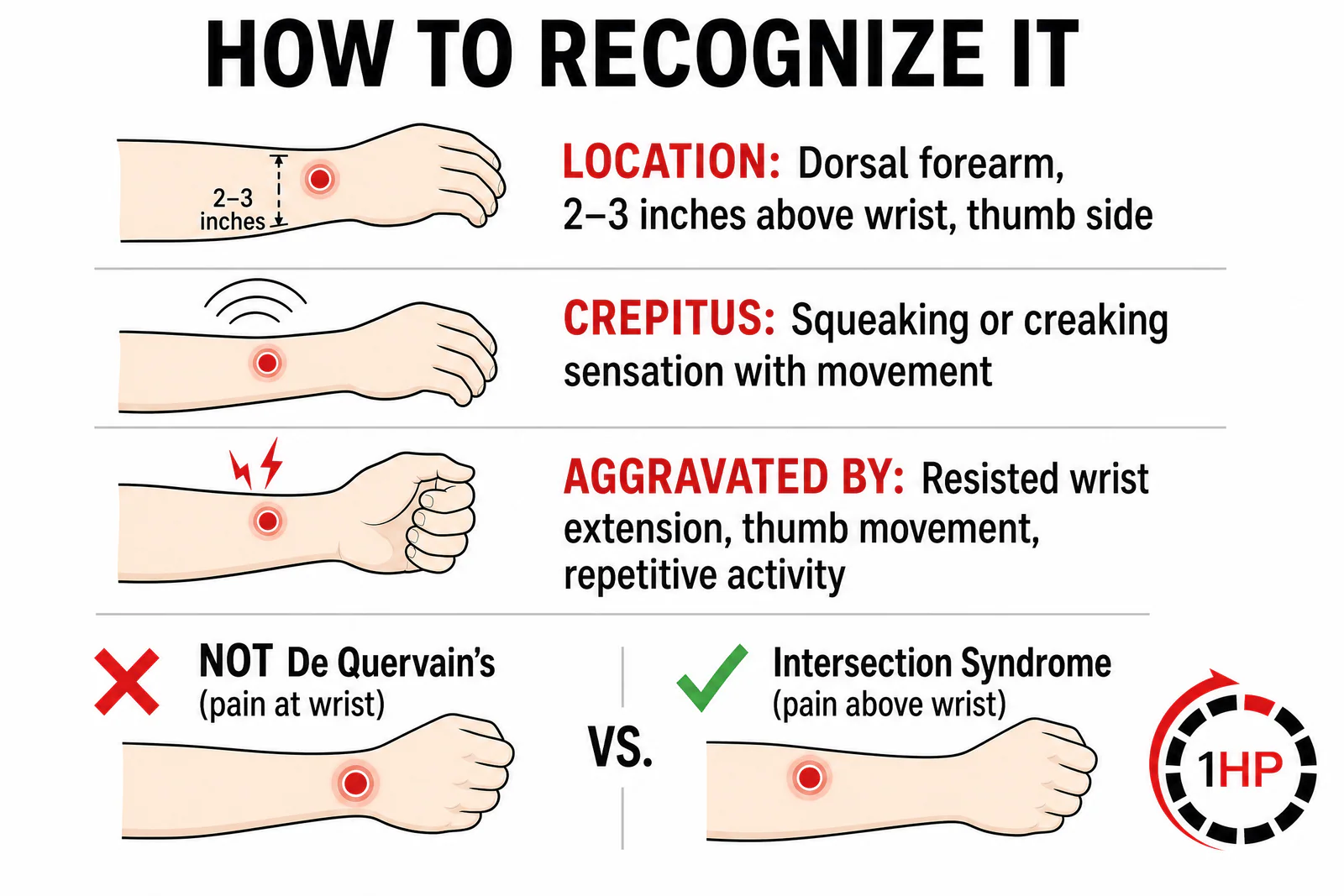 Recognizing Intersection Syndrome: Location and Crepitus Symptoms